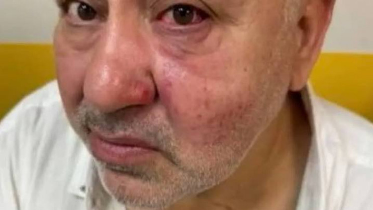 В пригороде Парижа еврея избили за кипу и звезду Давида на шее